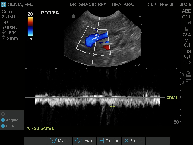 Ecocardiografía Doppler